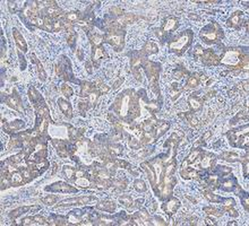 Cytokeratin 18/KRT18 Antibody