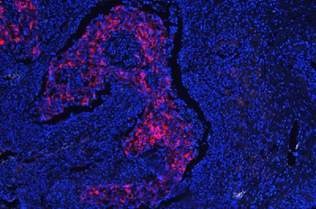 Cytokeratin 18/KRT18 Antibody