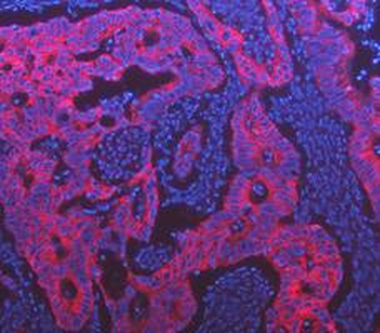 Cytokeratin 18/KRT18 Antibody