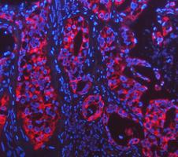 Cytokeratin 18/KRT18 Antibody