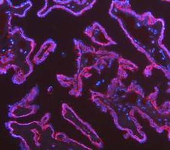 Cytokeratin 18/KRT18 Antibody