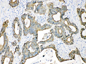 Cytokeratin 18/KRT18 Antibody