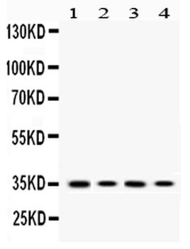 MC1 Receptor/MC1R Rabbit Polyclonal Antibody