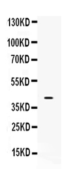 MC2 receptor/MC2R Rabbit Polyclonal Antibody