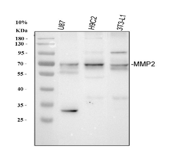 MMP2 Rabbit Polyclonal Antibody