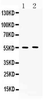 MMP11 Antibody