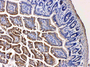 NARG1/NAA15 Rabbit Polyclonal Antibody