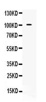 NARG1/NAA15 Rabbit Polyclonal Antibody