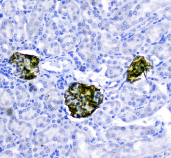 Nephrin/NPHS1 Rabbit Polyclonal Antibody