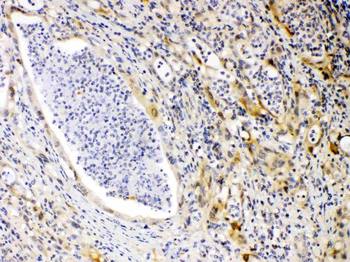 Protein Kinase A regulatory subunit I alpha/PRKAR1A Rabbit Polyclonal Antibody