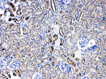 Protein C inhibitor/SERPINA5 Rabbit Polyclonal Antibody