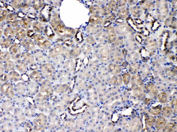 Protein C inhibitor/SERPINA5 Rabbit Polyclonal Antibody