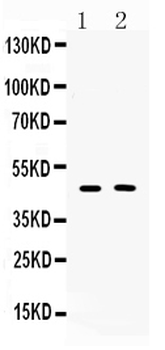 Protein C inhibitor/SERPINA5 Rabbit Polyclonal Antibody