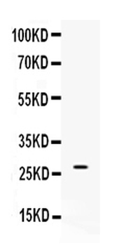 VEGF/Vegfa Rabbit Polyclonal Antibody