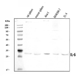 IL6 Rabbit Polyclonal Antibody