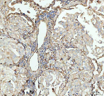 ICAM1 Antibody