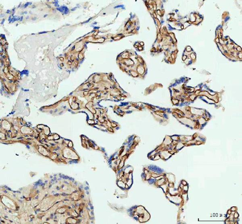 ICAM1 Antibody