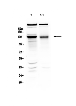 BMPR2 Rabbit Polyclonal Antibody