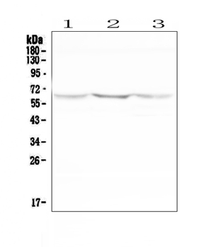 NOX2/gp91phox/CYBB Rabbit Polyclonal Antibody