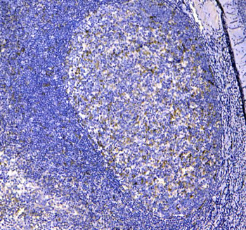 CD11c/ITGAX Rabbit Polyclonal Antibody