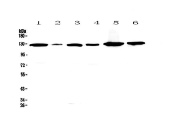 VEGF Receptor 1/FLT1 Rabbit Polyclonal Antibody
