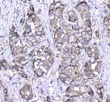 L1CAM Antibody