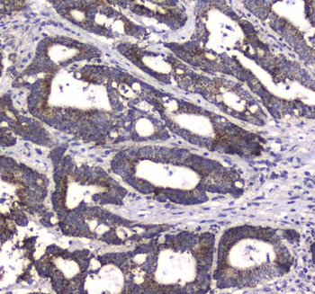 MRE11/MRE11 Rabbit Polyclonal Antibody
