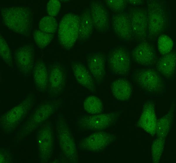 PER1 Rabbit Polyclonal Antibody