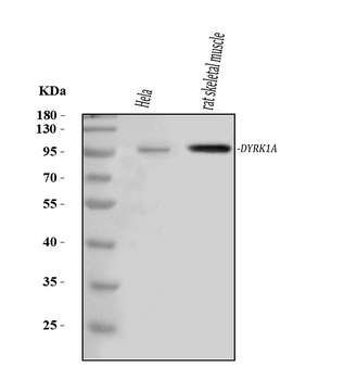 DYRK1A Rabbit Polyclonal Antibody