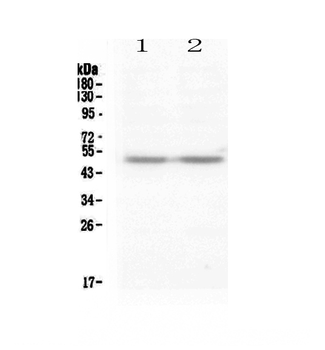 PAX8 Rabbit Polyclonal Antibody