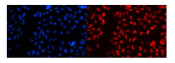 splicing factor 1/SF1 Rabbit Polyclonal Antibody