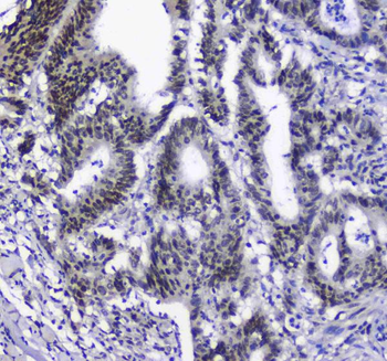 splicing factor 1/SF1 Rabbit Polyclonal Antibody