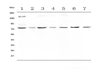 MST1 Rabbit Polyclonal Antibody