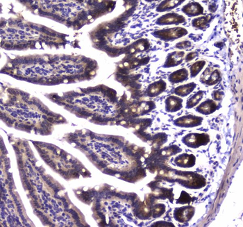 SDHB Rabbit Polyclonal Antibody