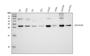 SDHB Rabbit Polyclonal Antibody