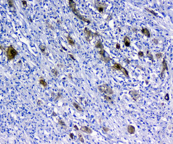 14-3-3 sigma/SFN/14 Rabbit Polyclonal Antibody