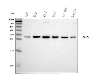 14-3-3 sigma/SFN/14 Rabbit Polyclonal Antibody