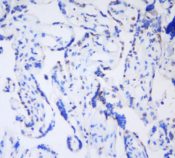 HP1 gamma/CBX3 Rabbit Polyclonal Antibody