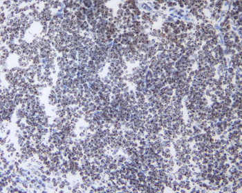 HP1 gamma/CBX3 Rabbit Polyclonal Antibody