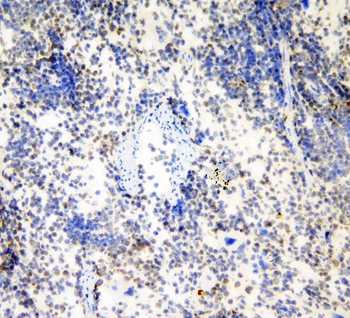 HP1 gamma/CBX3 Rabbit Polyclonal Antibody