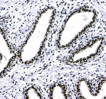 HP1 gamma/CBX3 Rabbit Polyclonal Antibody