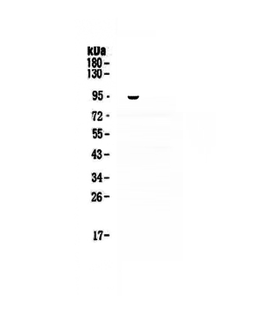 VCAM1 Rabbit Polyclonal Antibody