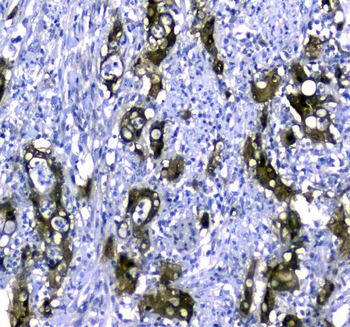 STUB1 Antibody