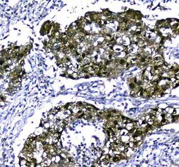 STUB1 Antibody