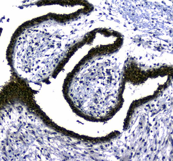 STUB1 Antibody
