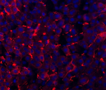 TAPA1/Cd81 Rabbit Polyclonal Antibody