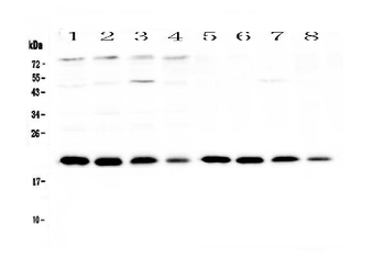 BNIP3 Rabbit Polyclonal Antibody