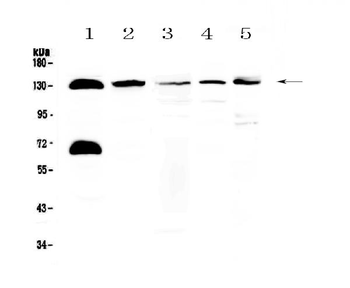 NEDD4-2/NEDD4L/NEDD4 Rabbit Polyclonal Antibody