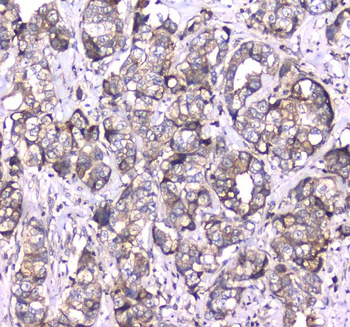 RAB27A Rabbit Polyclonal Antibody