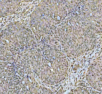 DCK Rabbit Polyclonal Antibody
